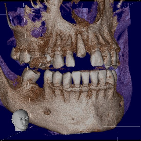 Petra Laboratory - Centru radiologie digitala stomatologica