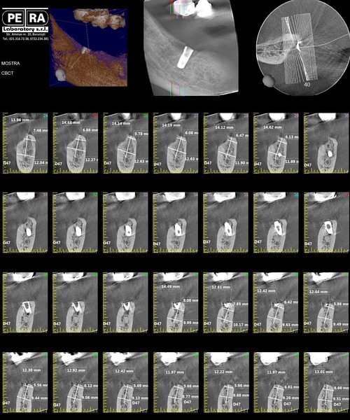 Petra Laboratory - Centru radiologie digitala stomatologica