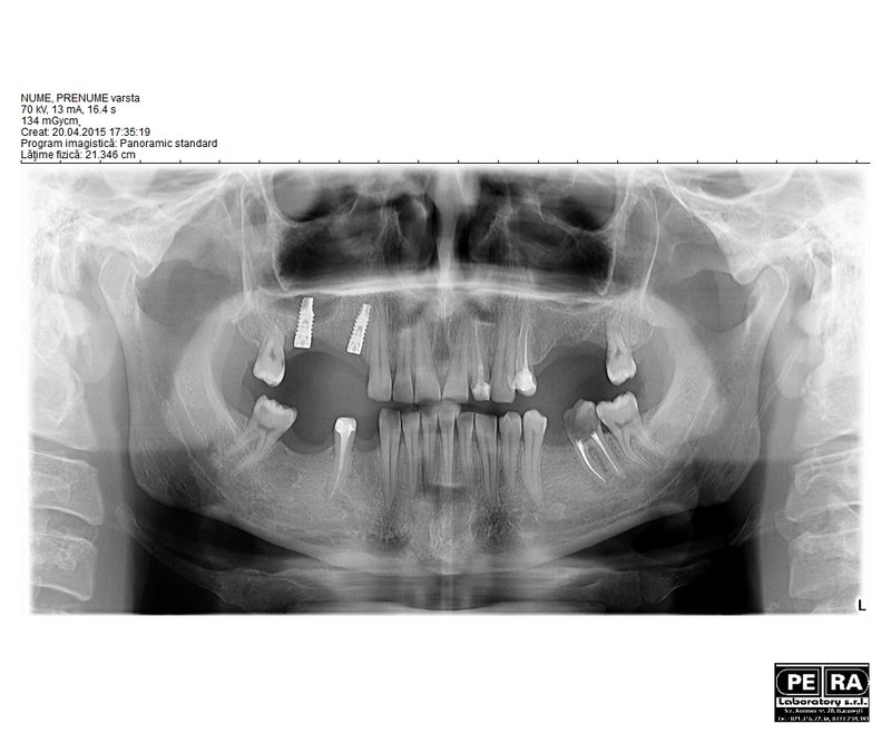 Petra Laboratory - Centru radiologie digitala stomatologica