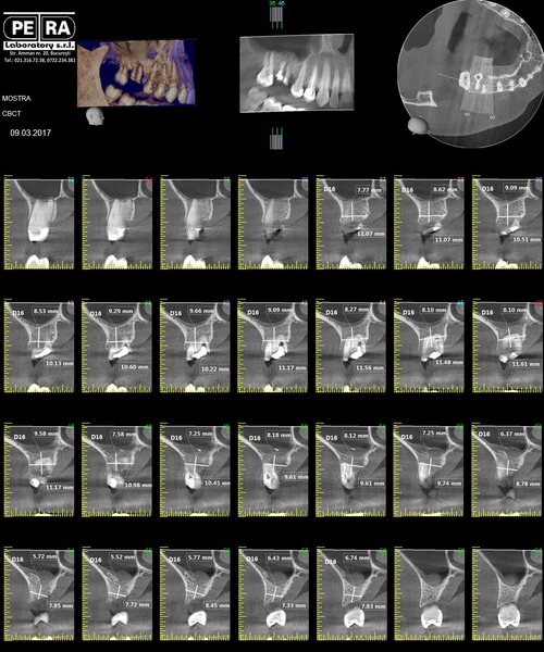 Petra Laboratory - Centru radiologie digitala stomatologica