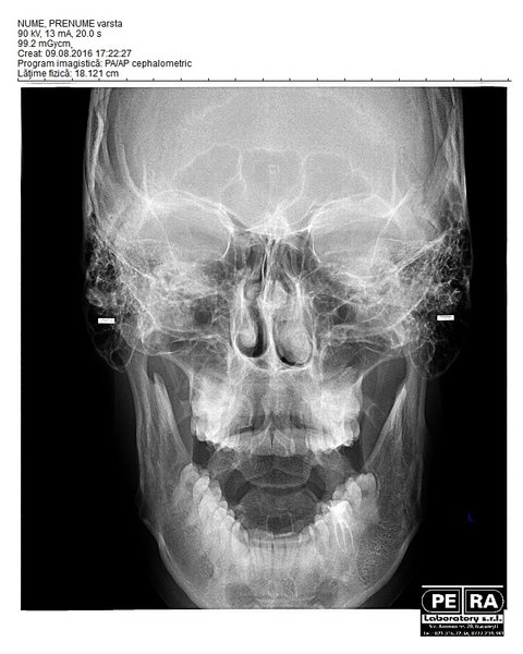 Petra Laboratory - Centru radiologie digitala stomatologica