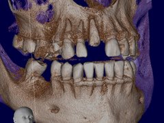 Petra Laboratory - Centru radiologie digitala stomatologica